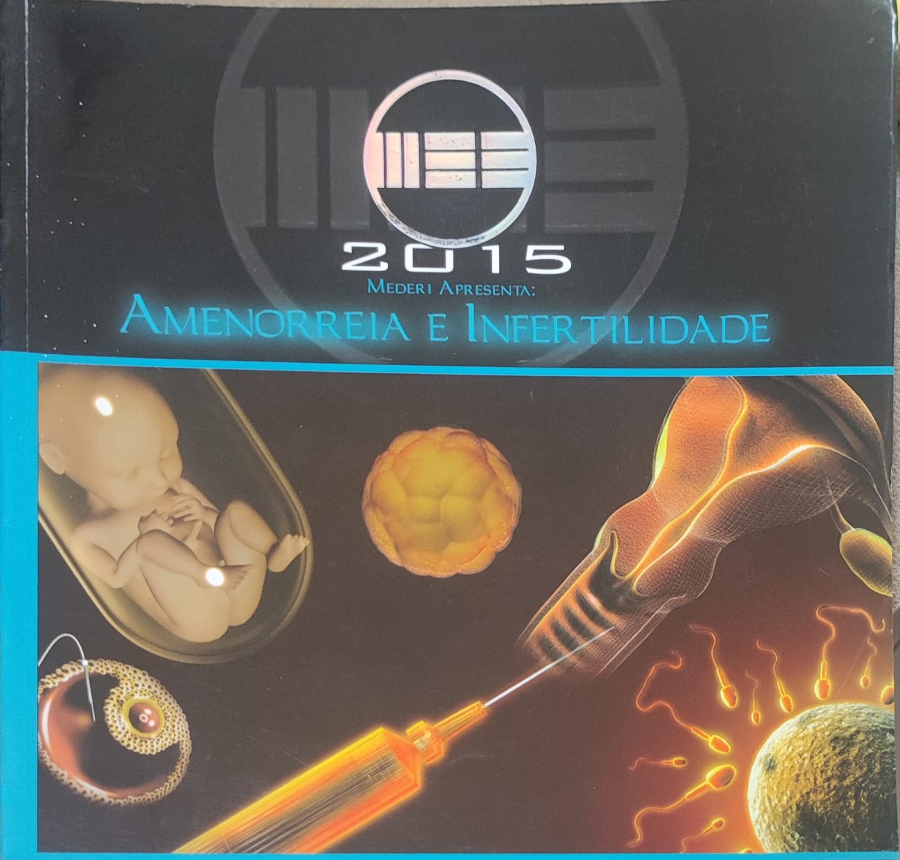 Amenorreria E Infertilidades